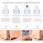Blackhead Remover Pore Vacuum